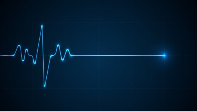 Cardiac monitor maker's security skips a beat as data thieves go for the jugular