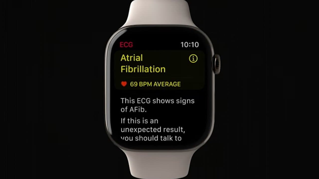 Triathlon runner credits Apple Watch for saving his life