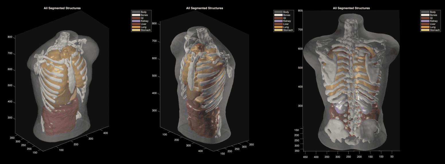 Something’s off with Midjourney’s pivot to body scanners